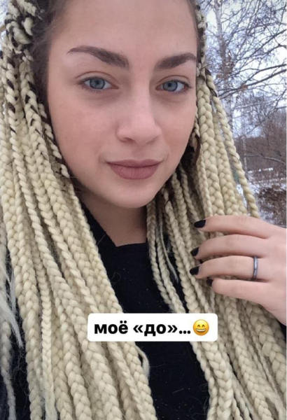 Из простушки с лишним весом и губами-ниточками в эффектную женщину: супруга Соколовского до уколов красоты